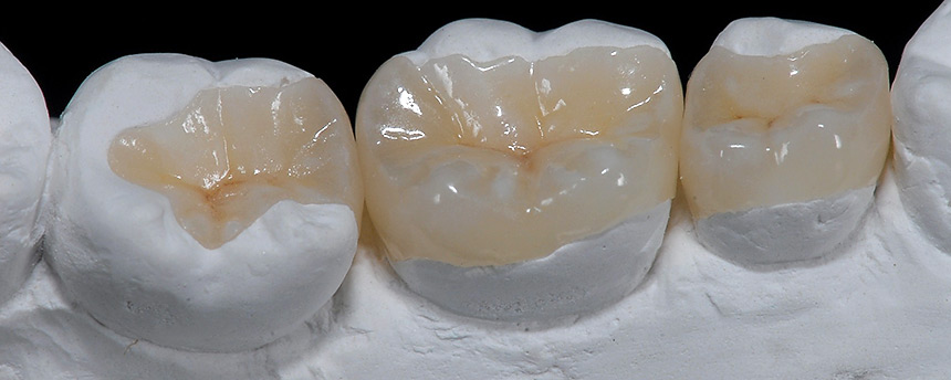 services 01b top entheta epentheta