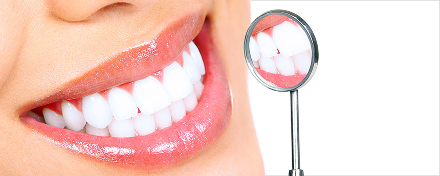 services 01e top opseis porselanis