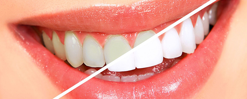 services 01f top leukansi dontiwn